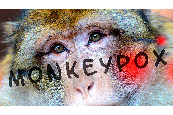 Оспу обезьян запланировали в 2020 году. Опубликованы планы убийства миллионов. ВИДЕО